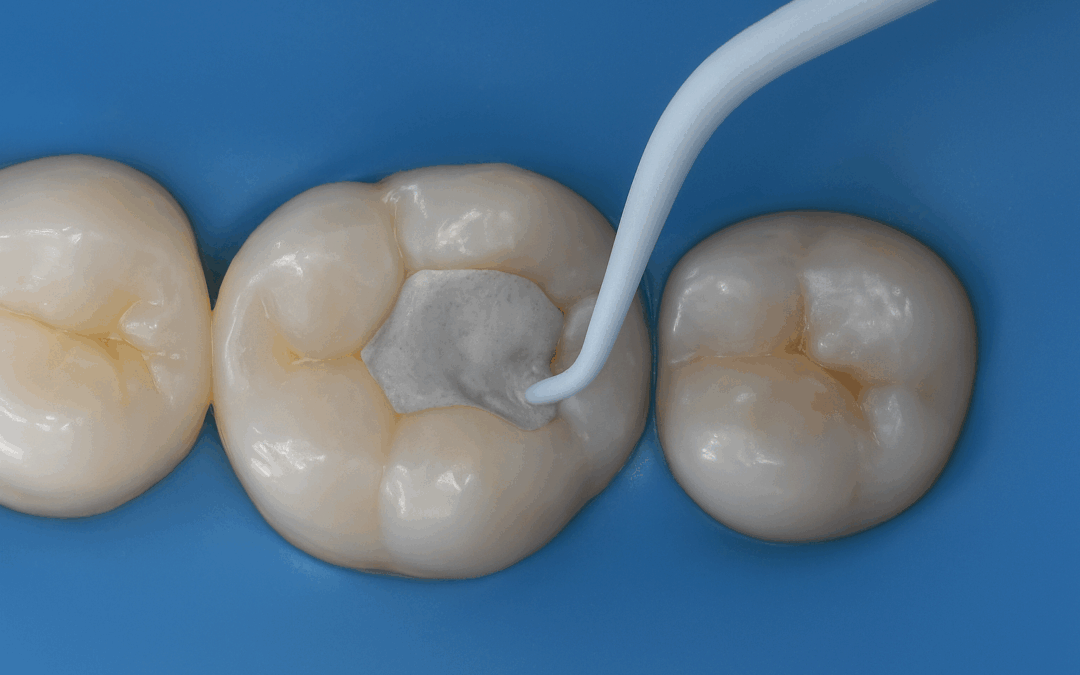 Biodentine™ XP – bioaktywny cement, który ratuje Twoje zęby
